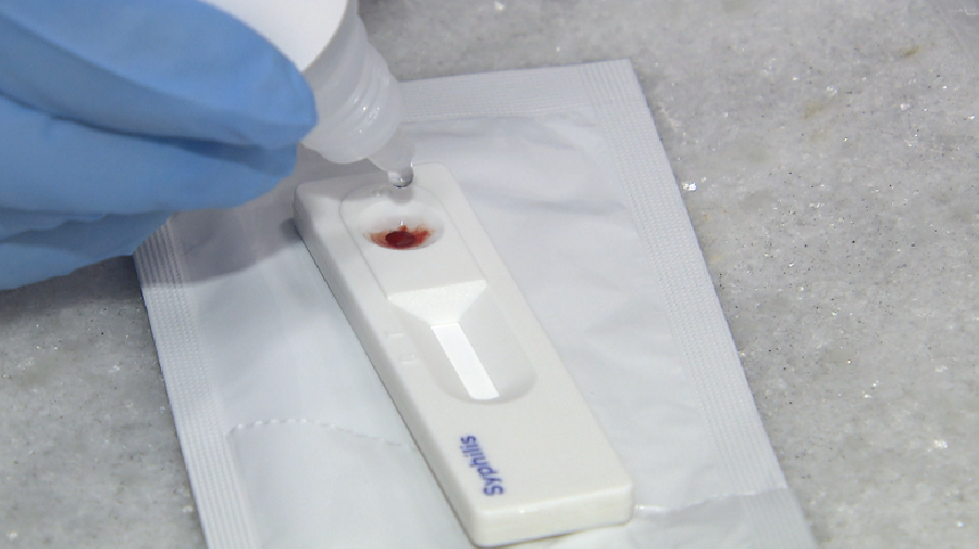 Mês de Enfrentamento da Sífilis: CTA reforça importância da prevenção e diagnóstico precoce