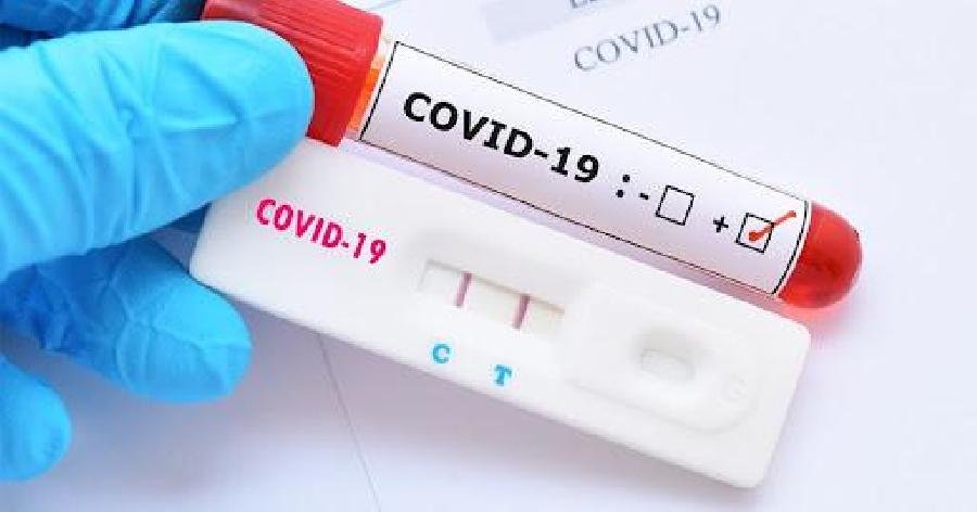 Ampla ação de testagem para Covid-19 acontece nesta quinta-feira (30)