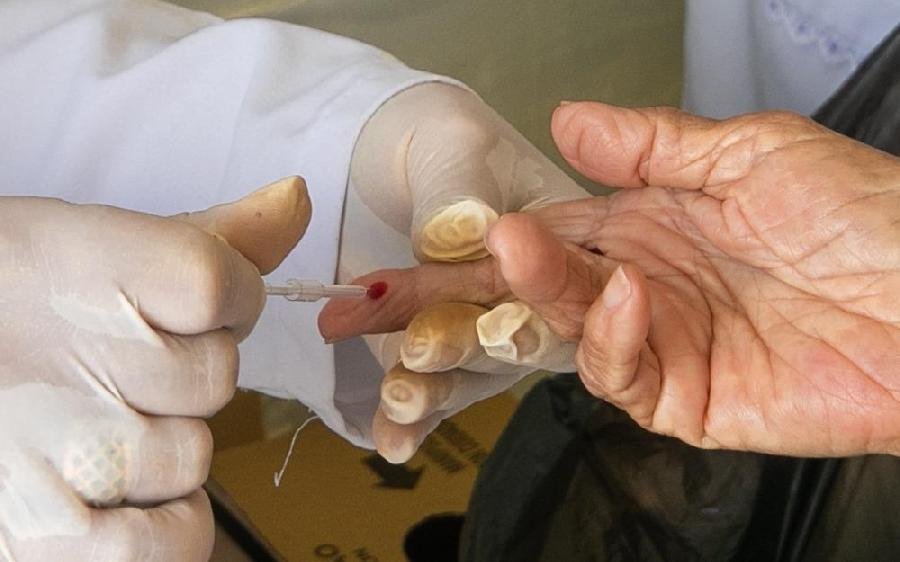 CTA realiza estratégia para disponibilizar testagem de hepatites virais nos bairros